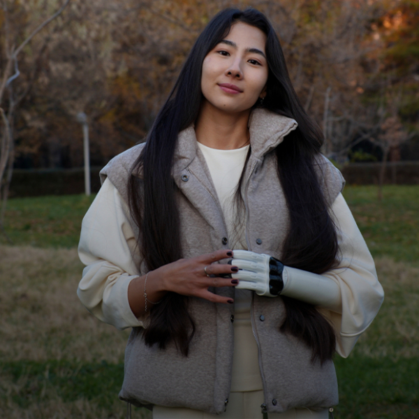 «Детям не объяснишь, почему руки нет — проще было ее спрятать в карман»